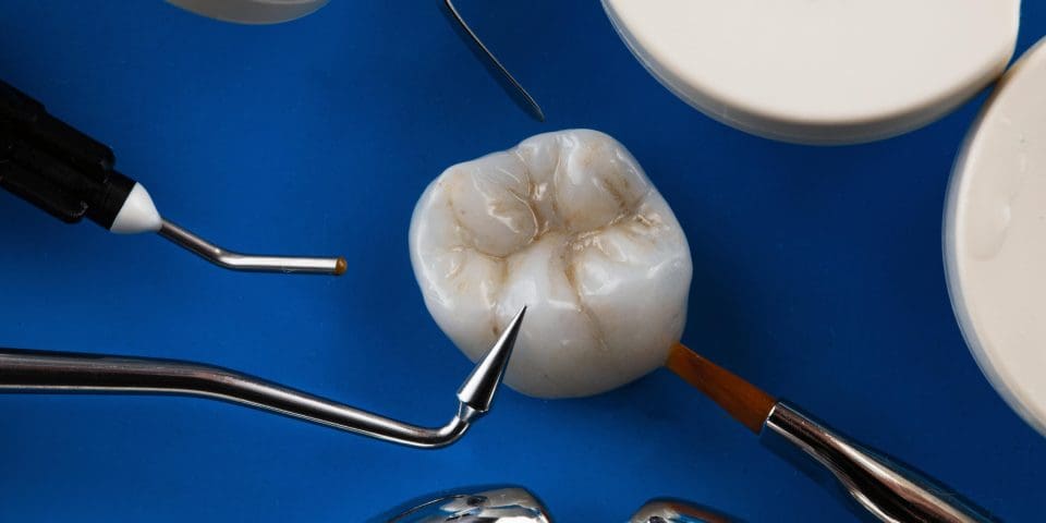 kompozit diş dolgusu