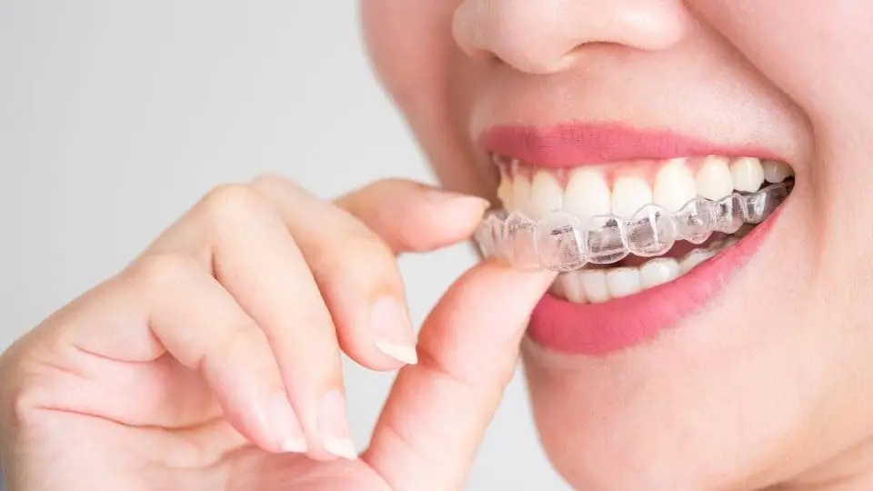 invisalign şeffaf plak