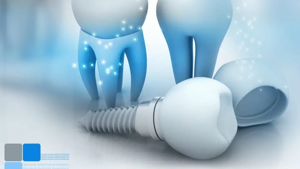 implant diş akademya